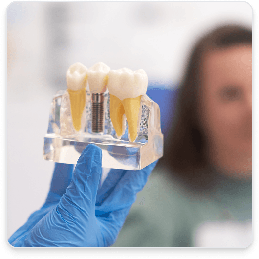 Single Implant with Crown