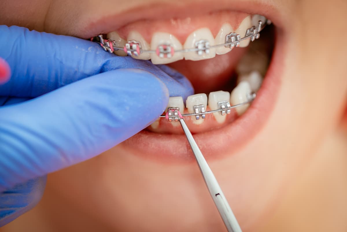 Dentist with child patient