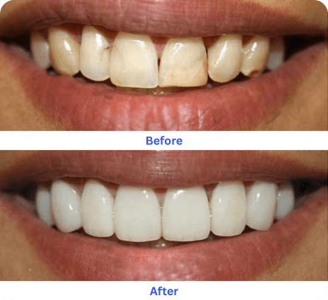 Whitening transformation before