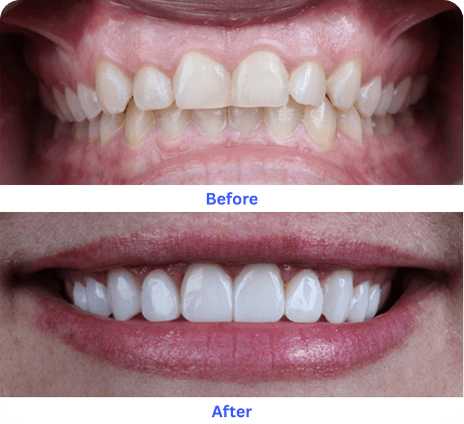 Whitening transformation after