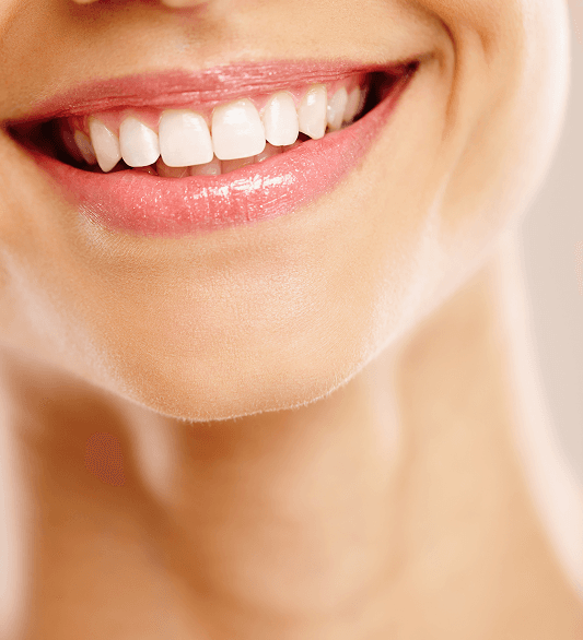 Professional teeth whitening results