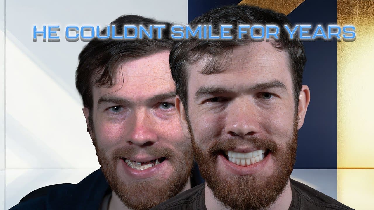 Patient Overcomes Severe Decay with Amazing Results